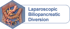 Laparoscopic Biliopancreatic Diversion